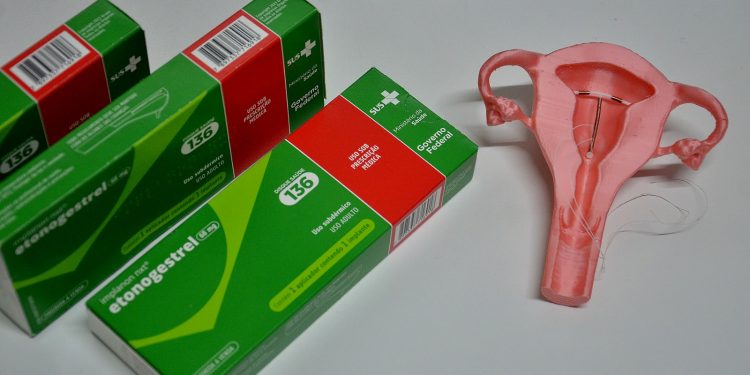 Prefeitura de Campina Grande amplia oferta do implante contraceptivo subdérmico em UBSs e serviços especializados